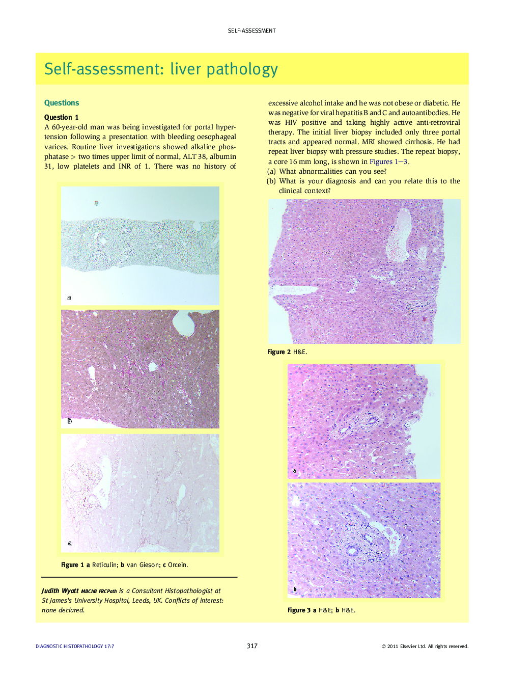 Self-assessment: liver pathology