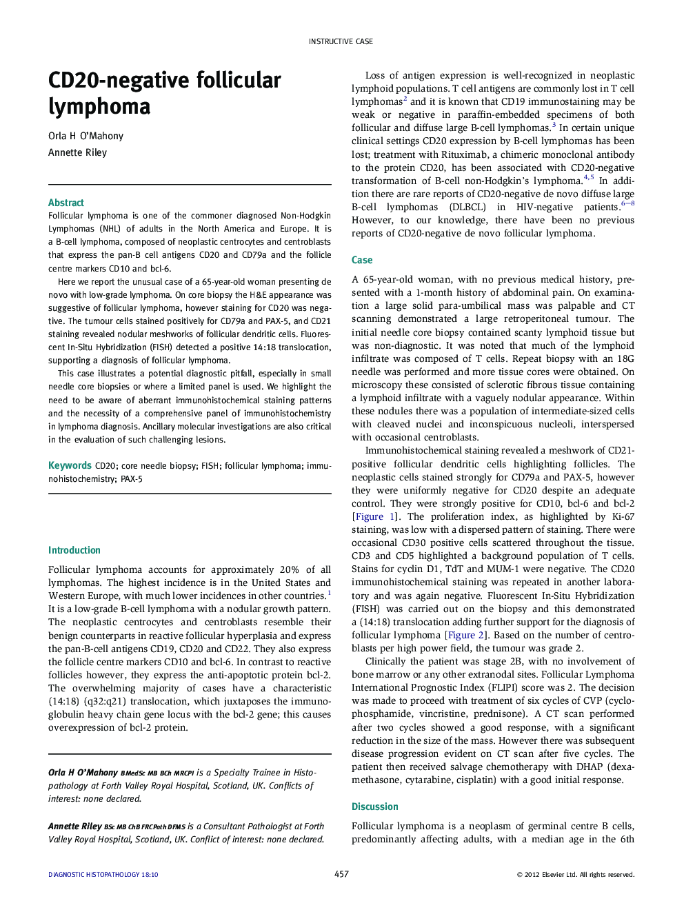 CD20-negative follicular lymphoma