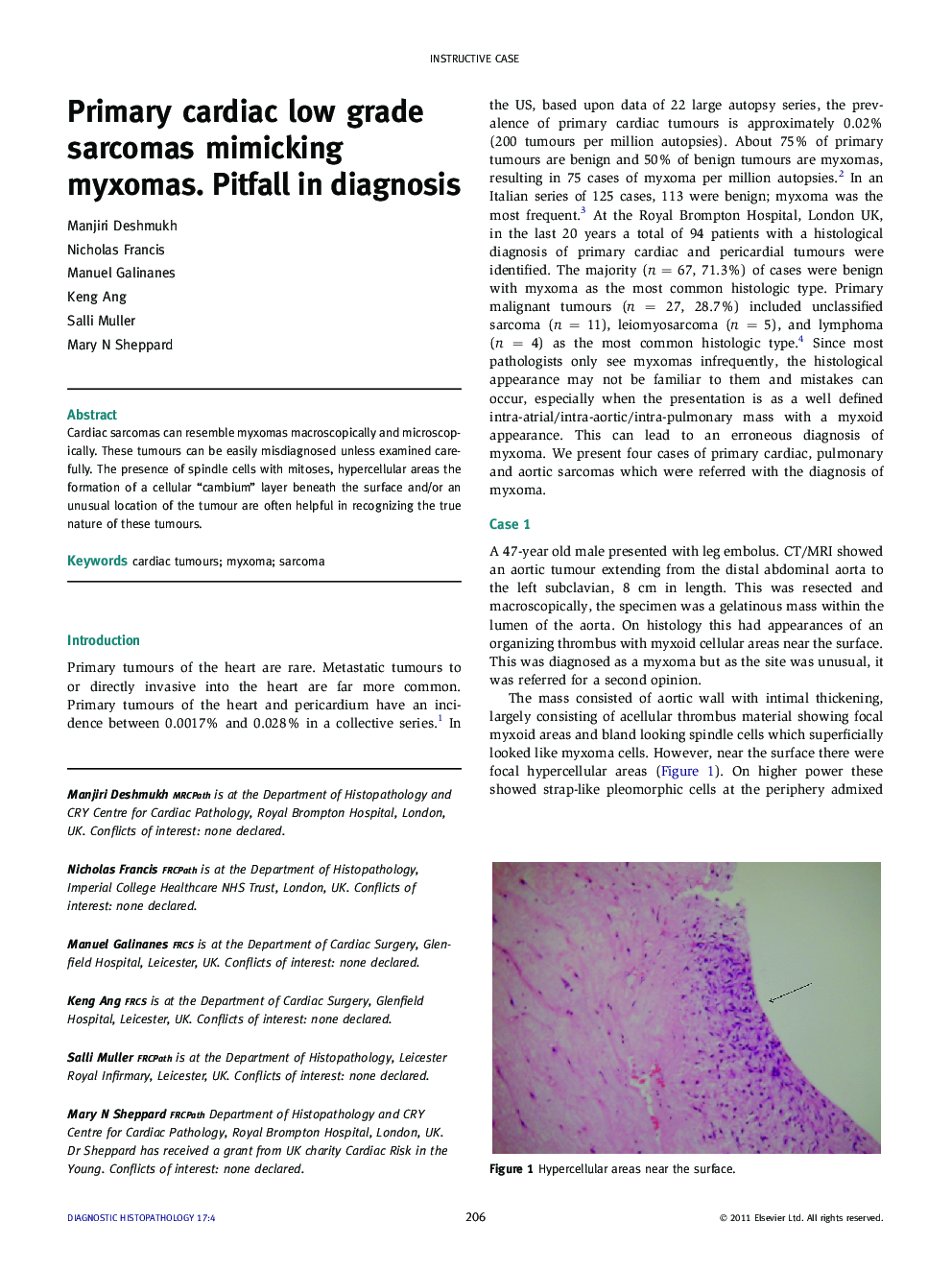 Primary cardiac low grade sarcomas mimicking myxomas. Pitfall in diagnosis