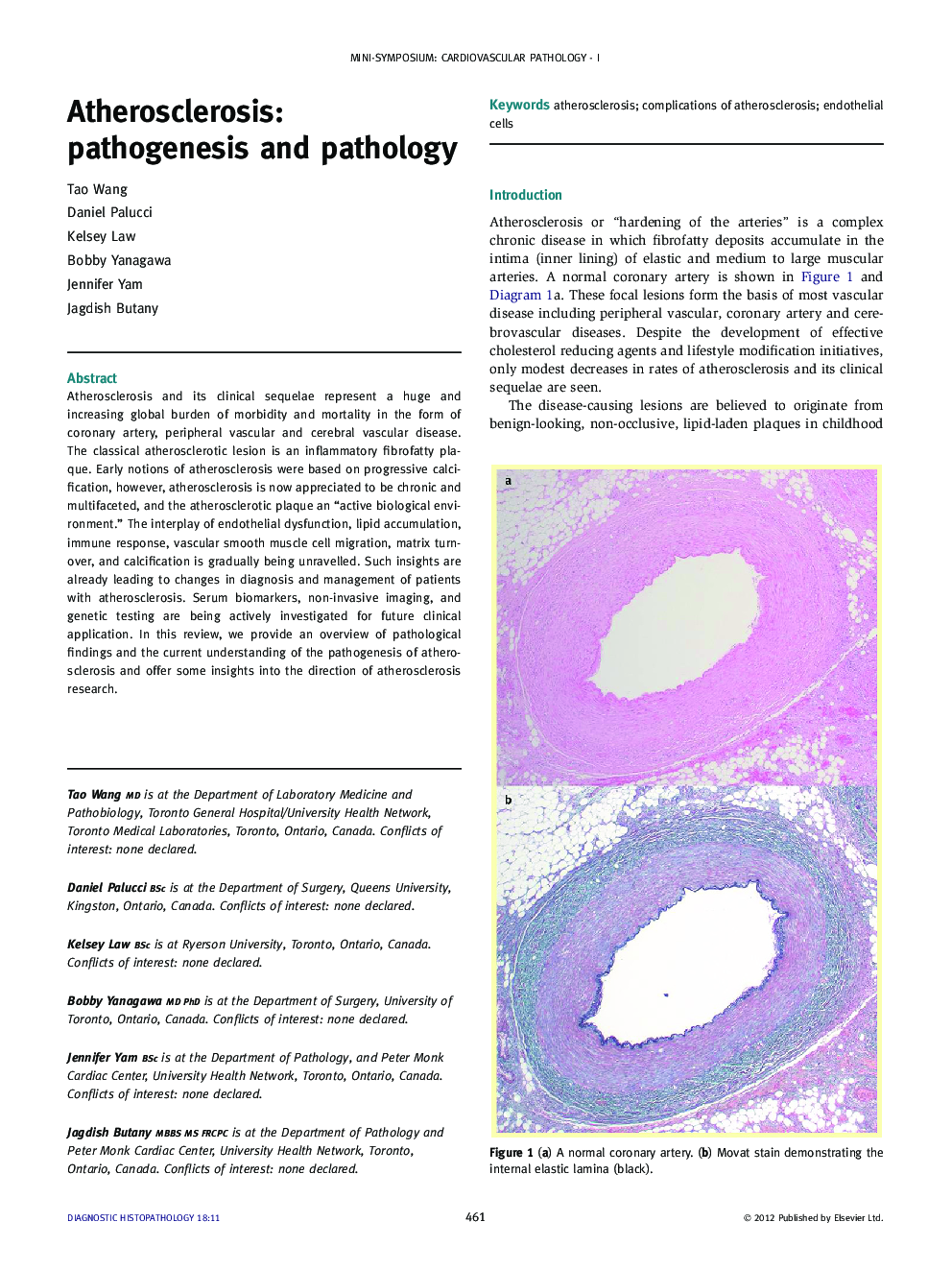 Atherosclerosis: pathogenesis and pathology