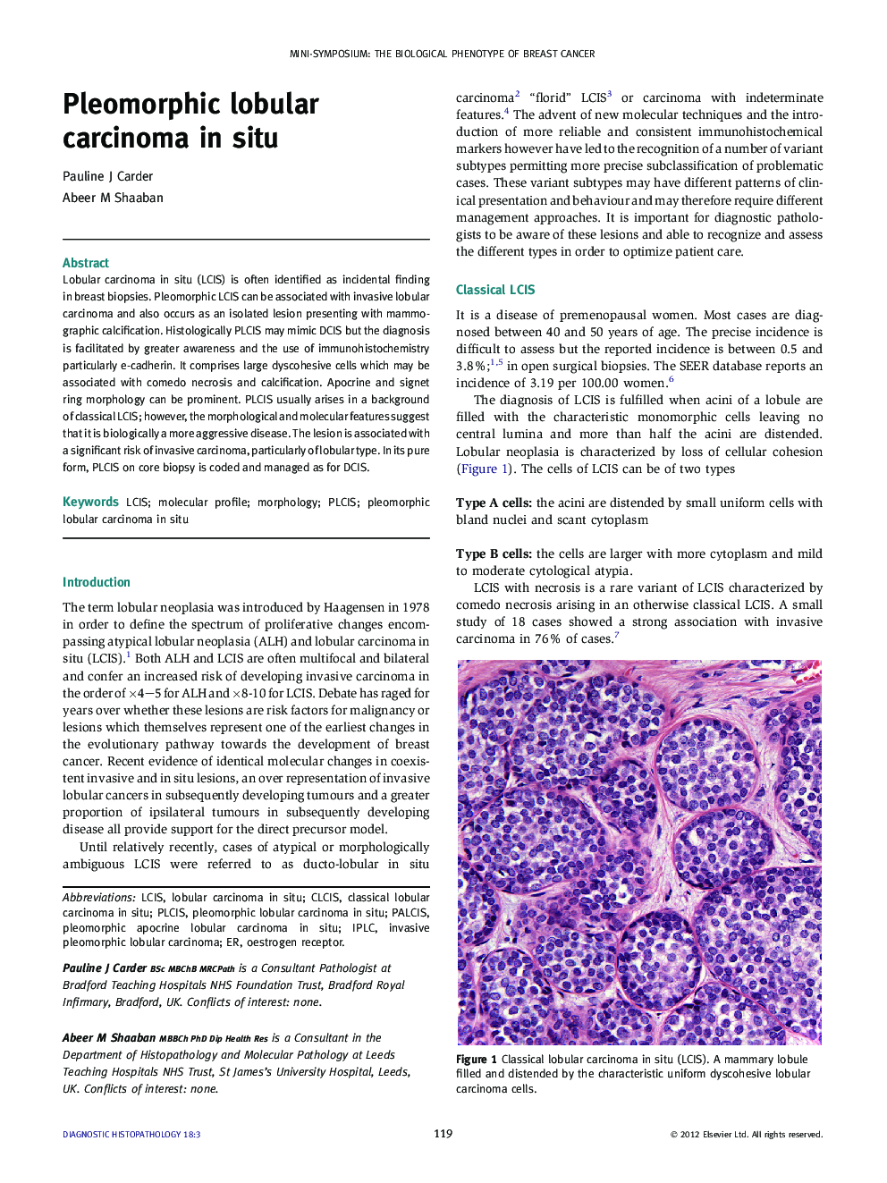 Pleomorphic lobular carcinoma in situ