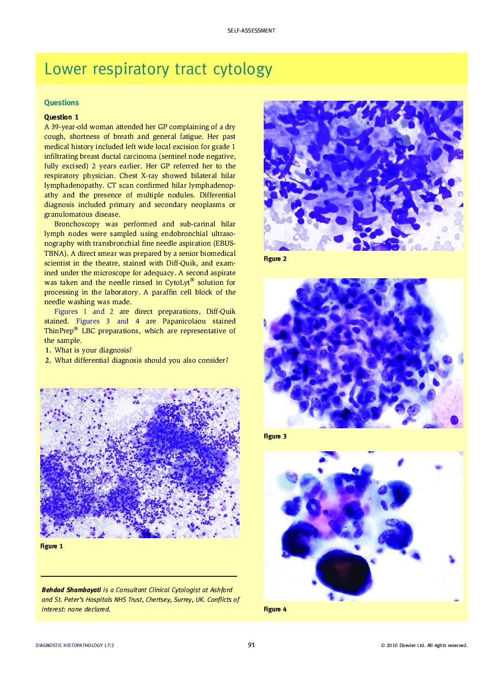 Lower respiratory tract cytology