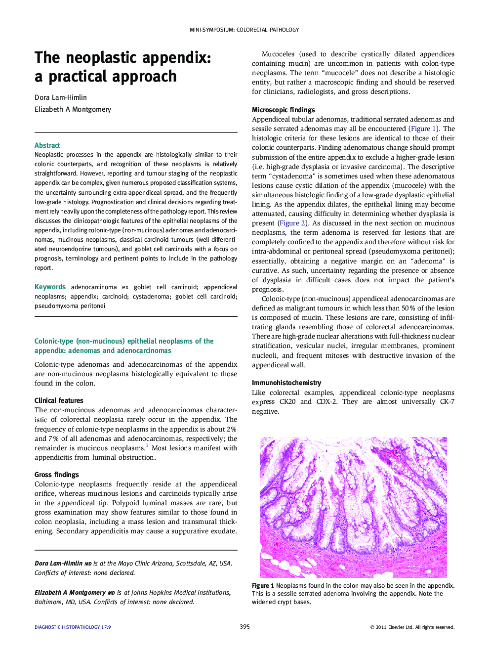 The neoplastic appendix: a practical approach