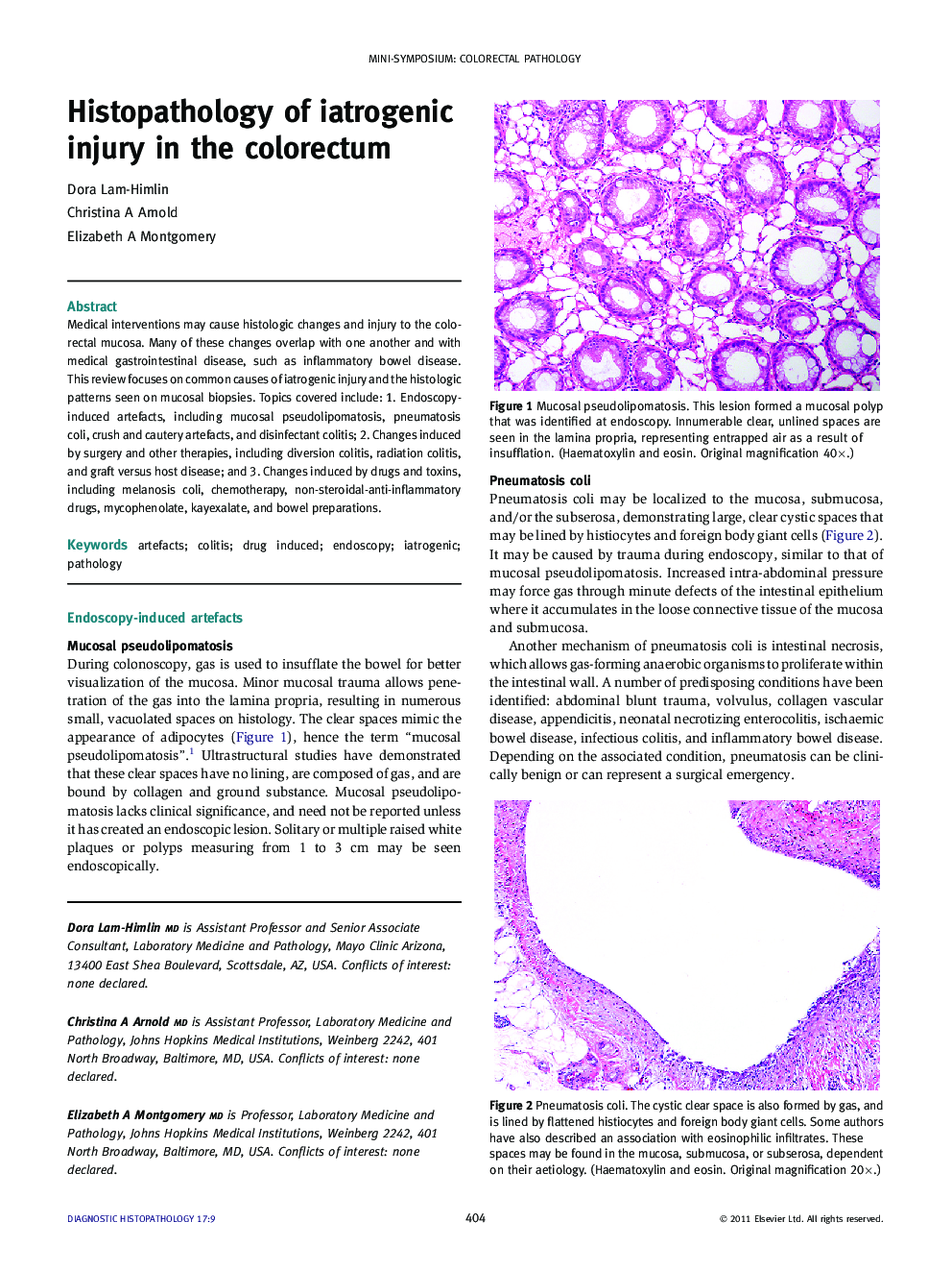 Histopathology of iatrogenic injury in the colorectum