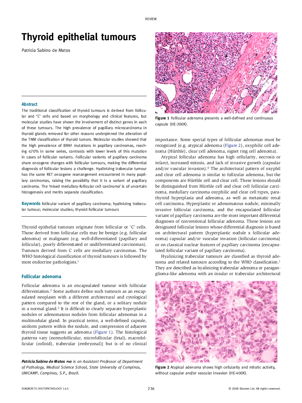 Thyroid epithelial tumours