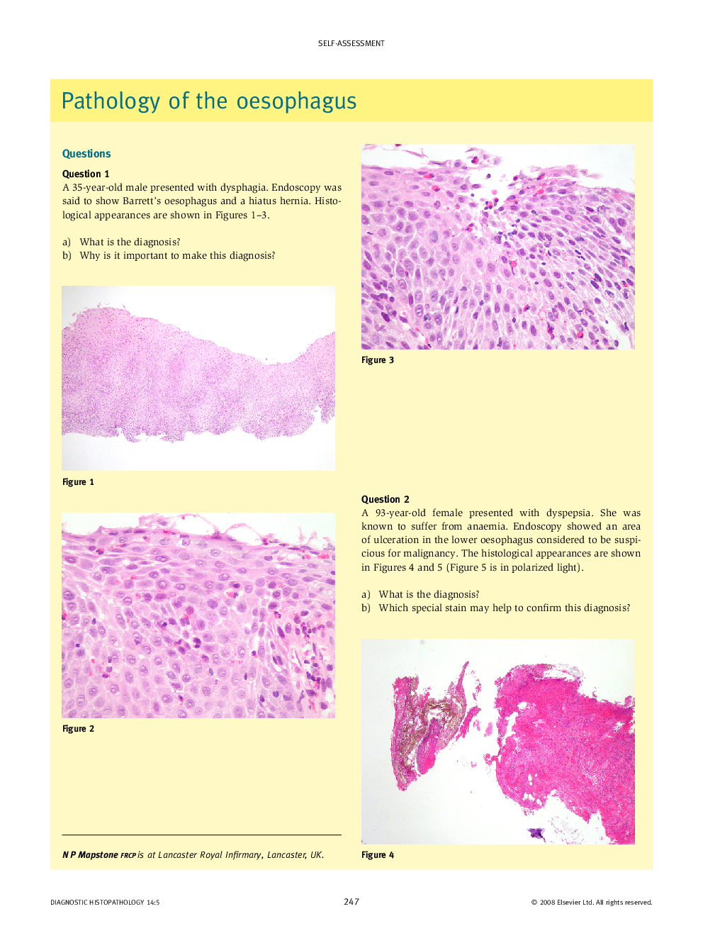 Pathology of the oesophagus