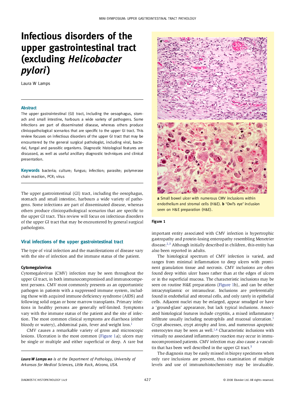 Infectious disorders of the upper gastrointestinal tract (excluding Helicobacter pylori   )