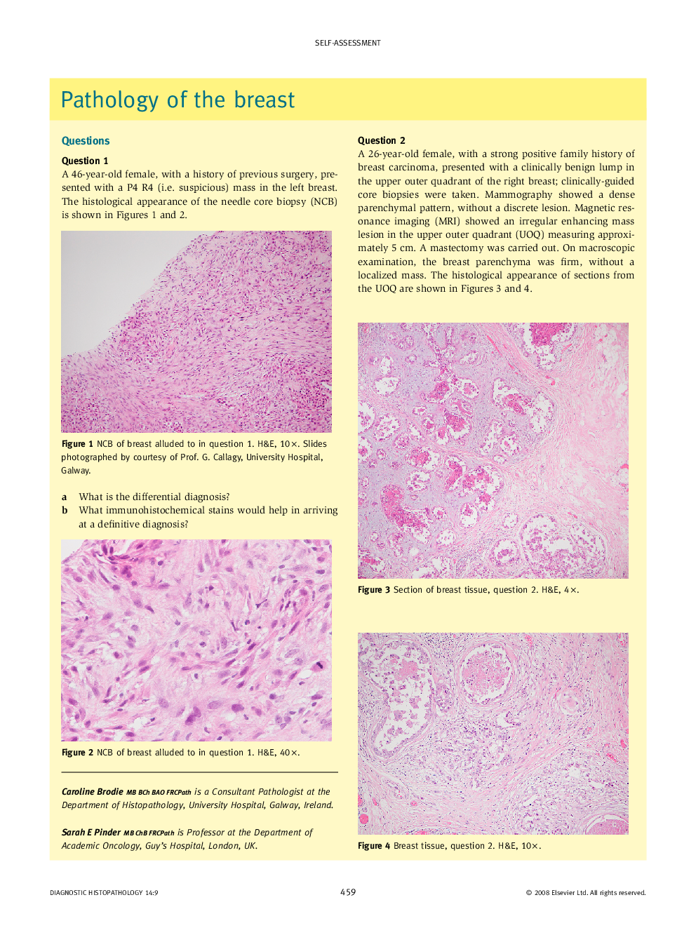 Pathology of the breast