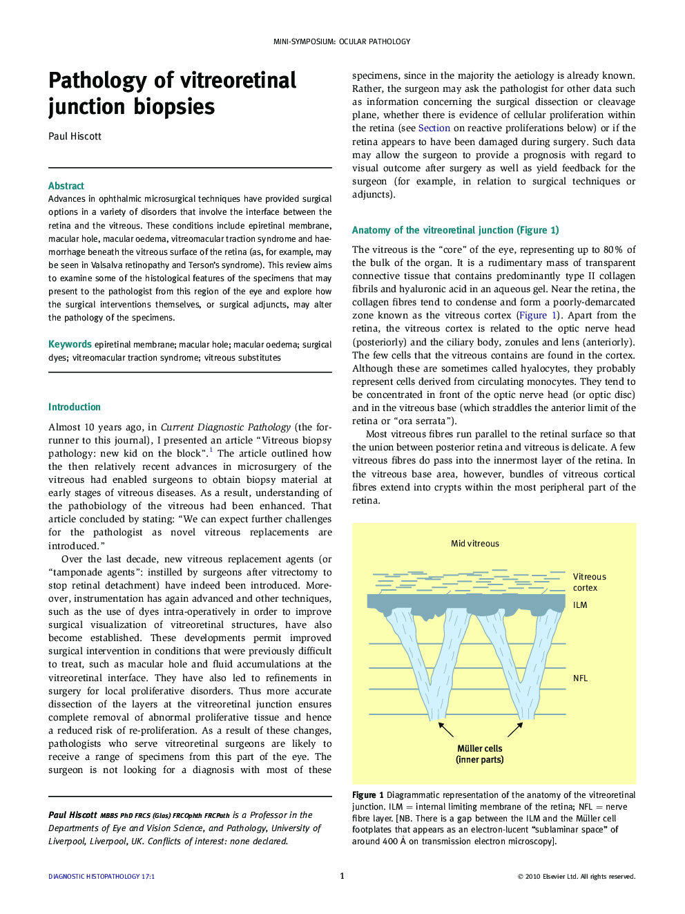 Pathology of vitreoretinal junction biopsies