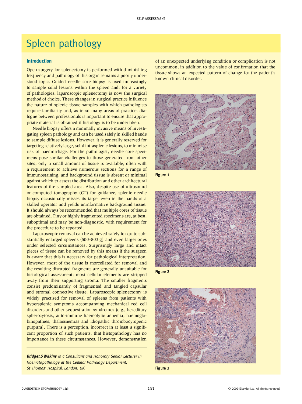 Spleen pathology