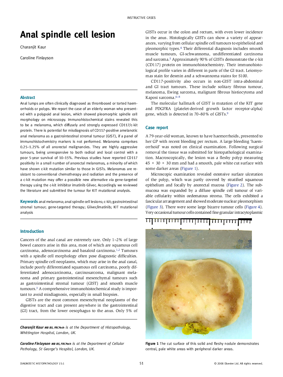 Anal spindle cell lesion