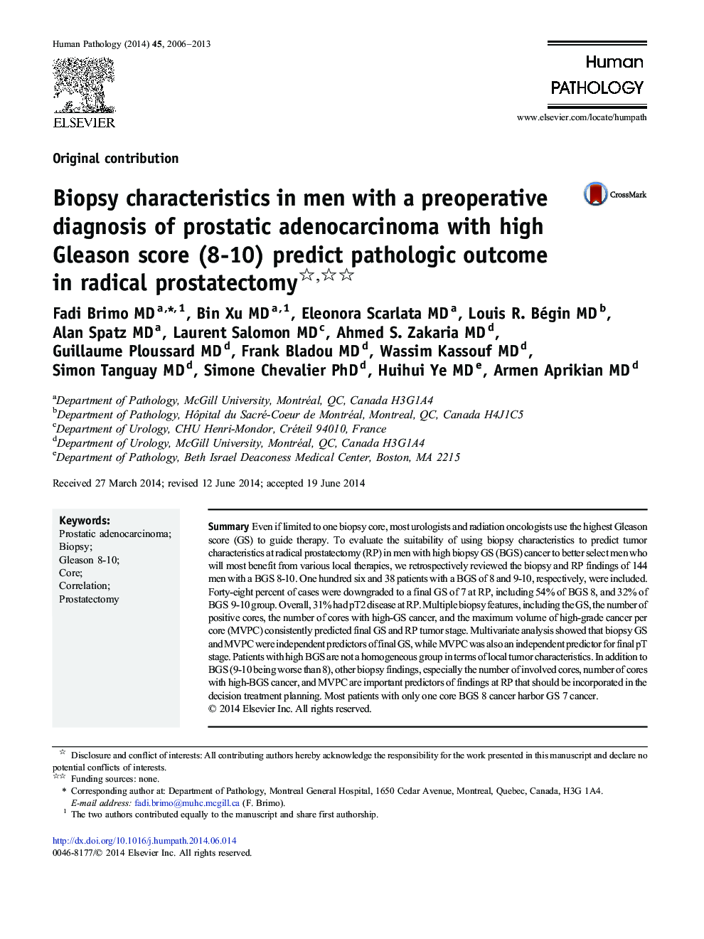 Biopsy characteristics in men with a preoperative diagnosis of prostatic adenocarcinoma with high Gleason score (8-10) predict pathologic outcome in radical prostatectomy 