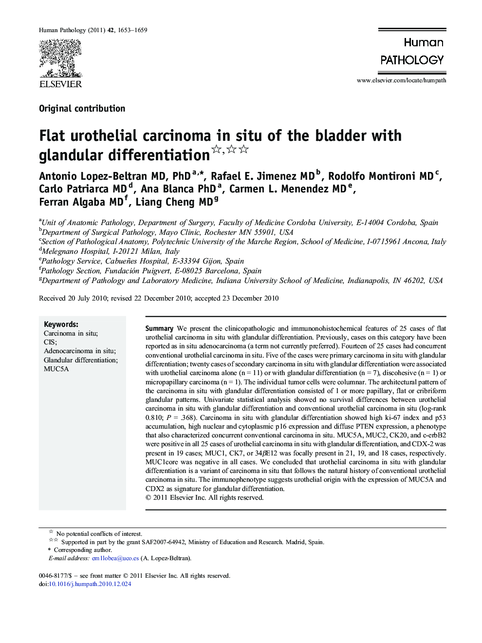 Flat urothelial carcinoma in situ of the bladder with glandular differentiation 