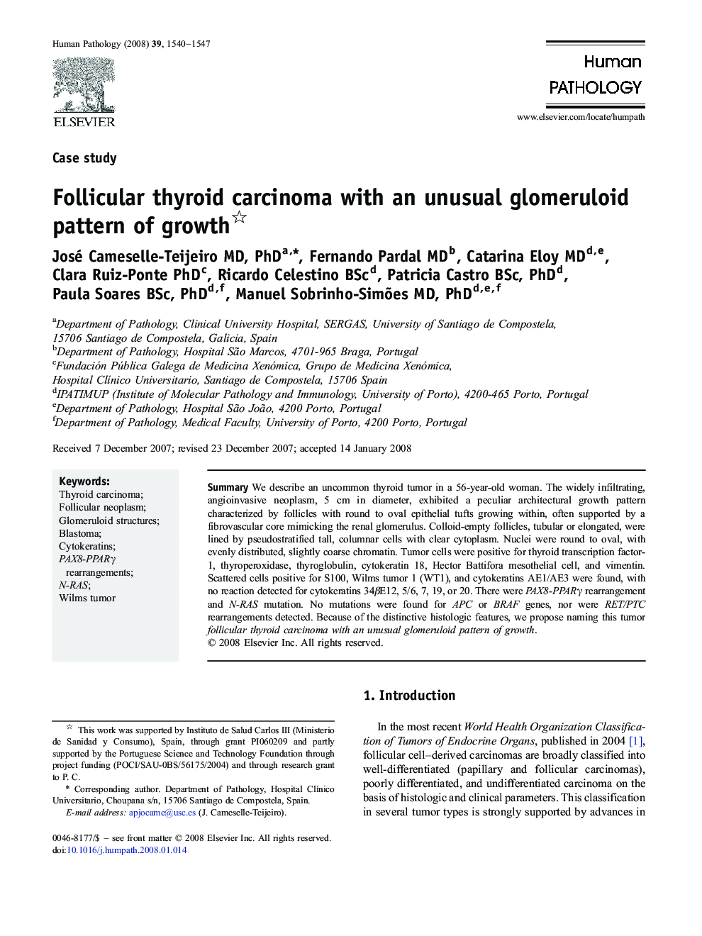 Follicular thyroid carcinoma with an unusual glomeruloid pattern of growth 