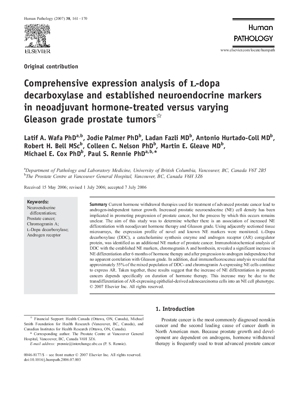 Comprehensive expression analysis of l-dopa decarboxylase and established neuroendocrine markers in neoadjuvant hormone-treated versus varying Gleason grade prostate tumors 