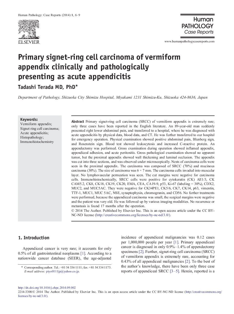 Primary signet-ring cell carcinoma of vermiform appendix clinically and pathologically presenting as acute appendicitis