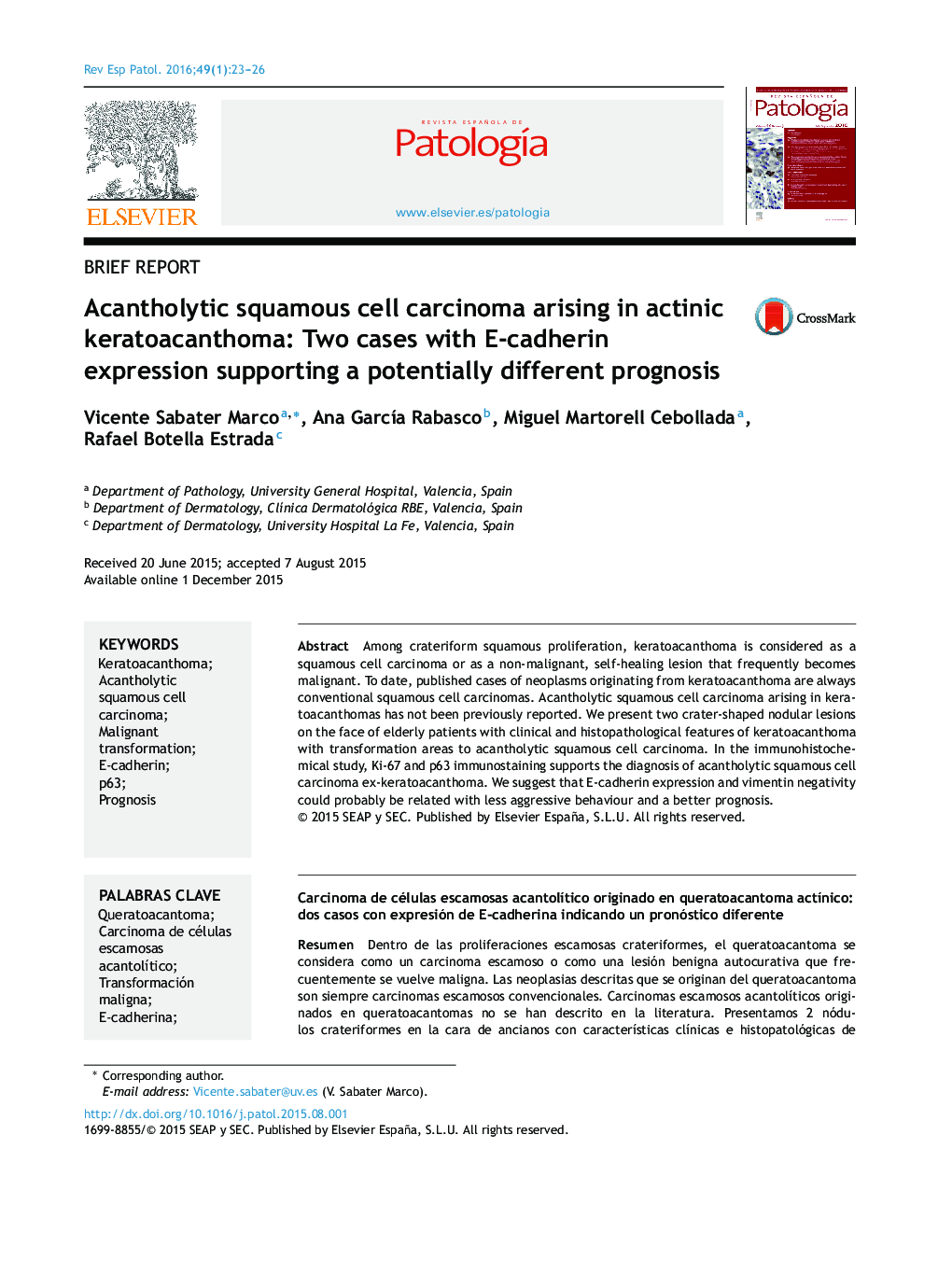 Acantholytic squamous cell carcinoma arising in actinic keratoacanthoma: Two cases with E-cadherin expression supporting a potentially different prognosis