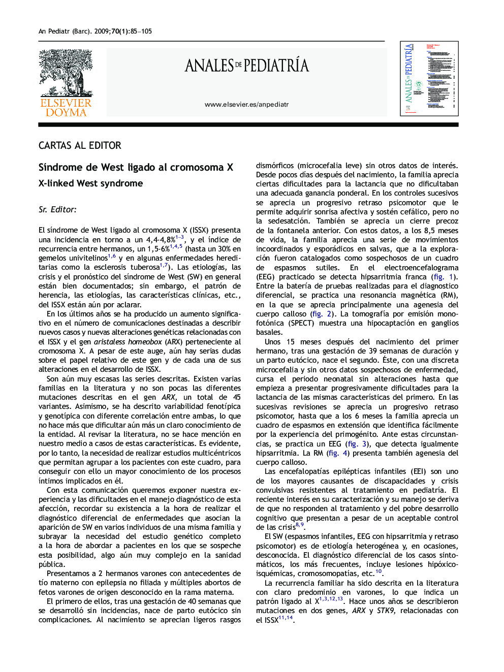 SÃ­ndrome de West ligado al cromosoma X