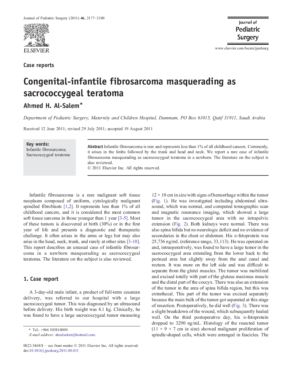 Congenital-infantile fibrosarcoma masquerading as sacrococcygeal teratoma