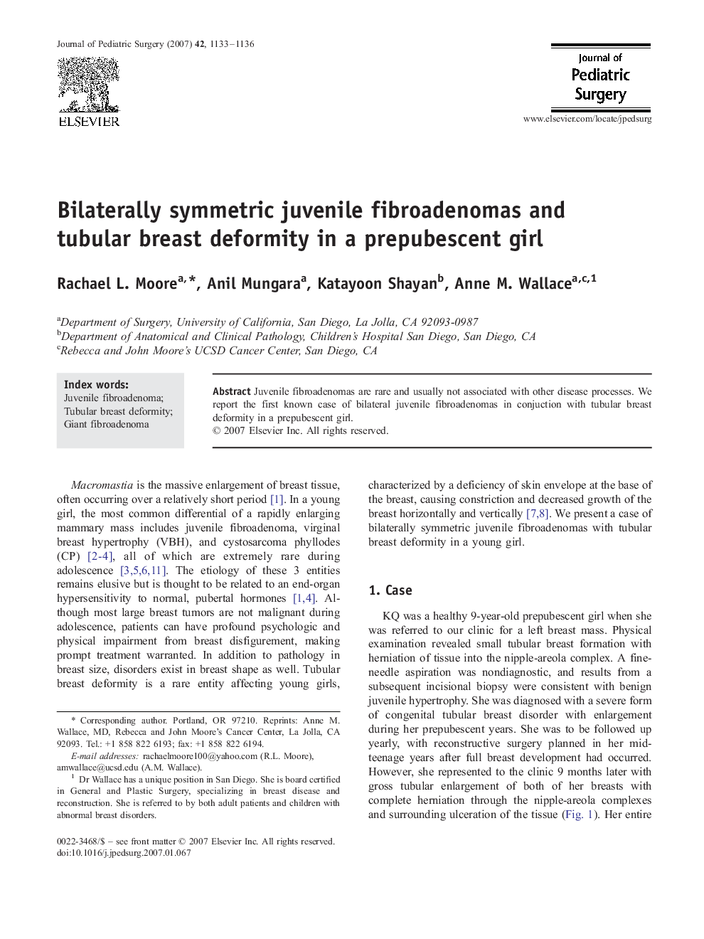 Bilaterally symmetric juvenile fibroadenomas and tubular breast deformity in a prepubescent girl