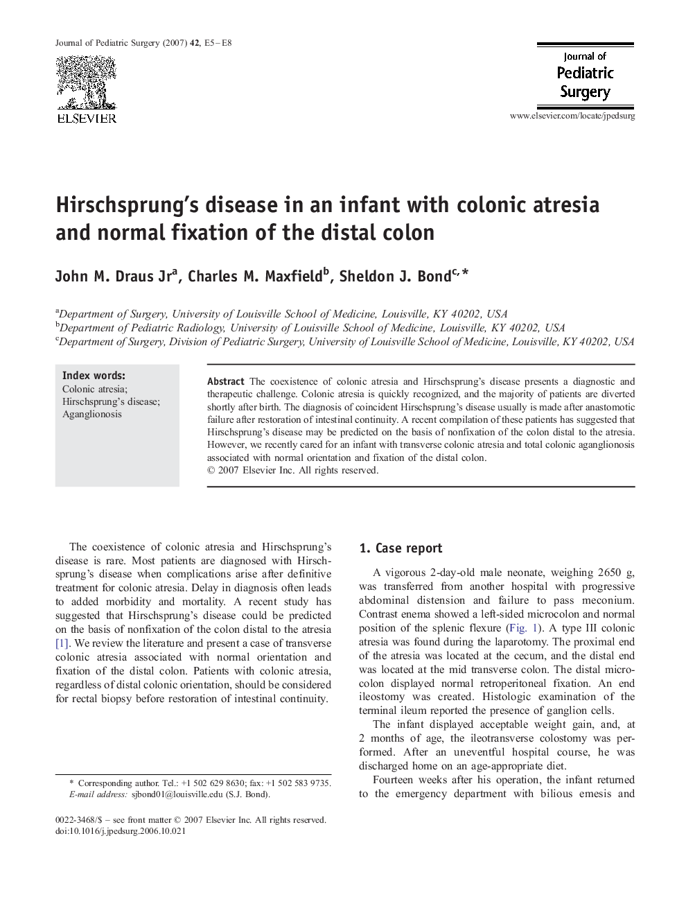 Hirschsprung's disease in an infant with colonic atresia and normal fixation of the distal colon