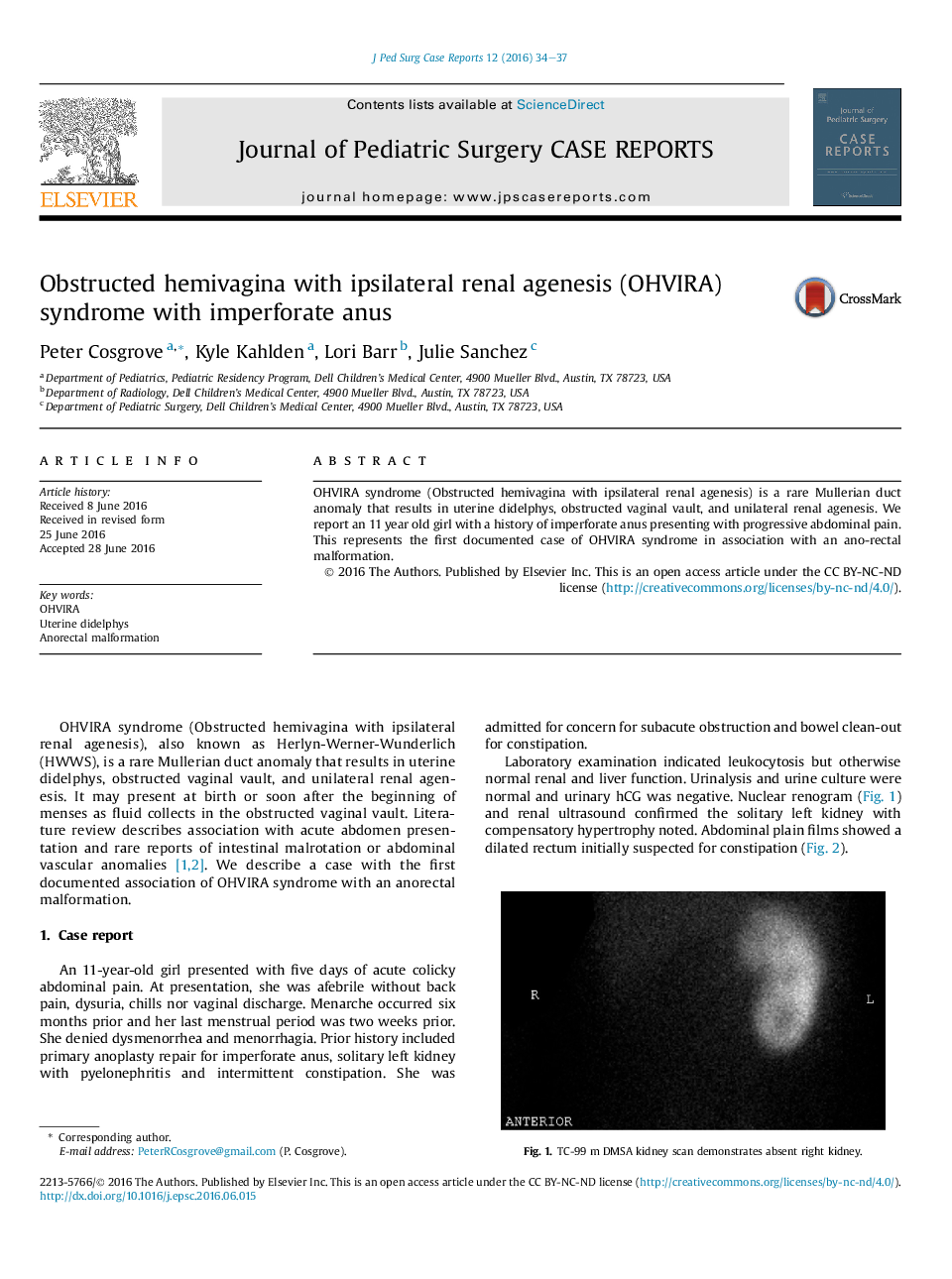 Obstructed hemivagina with ipsilateral renal agenesis (OHVIRA) syndrome with imperforate anus