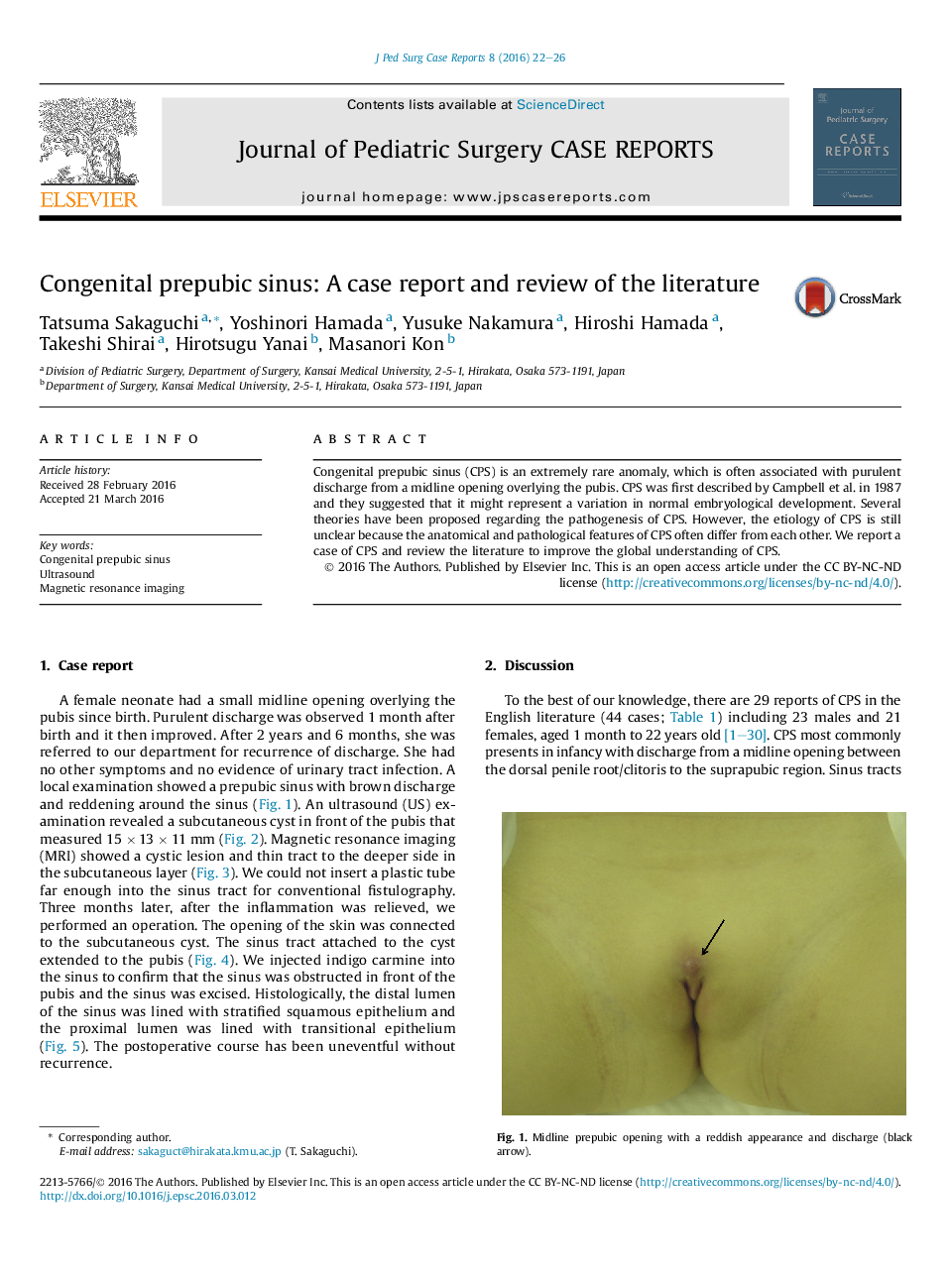 Congenital prepubic sinus: A case report and review of the literature