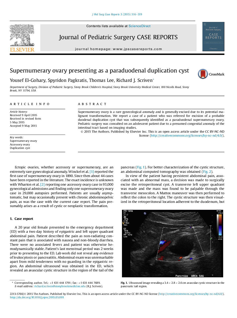 Supernumerary ovary presenting as a paraduodenal duplication cyst