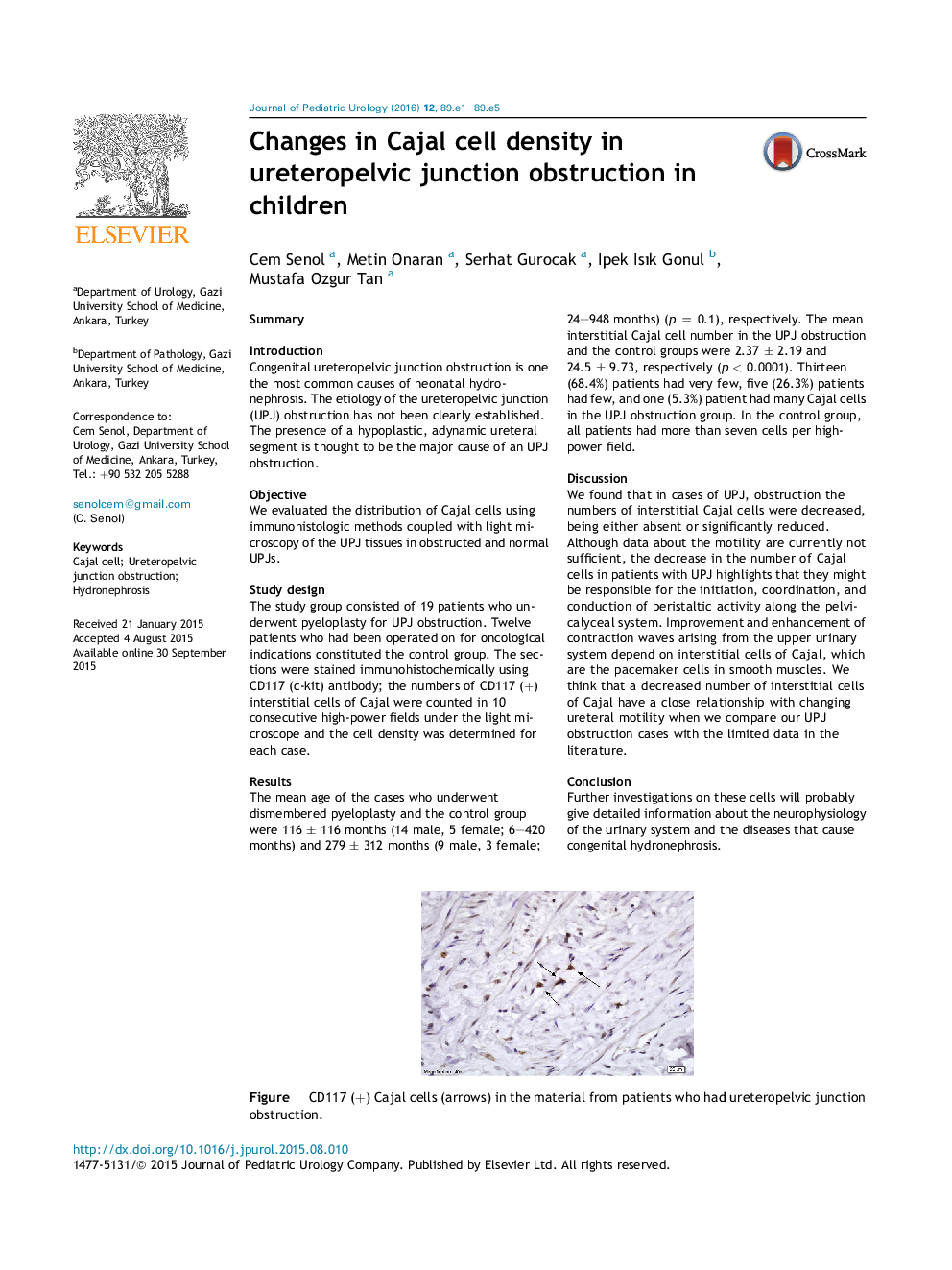 Changes in Cajal cell density in ureteropelvic junction obstruction in children