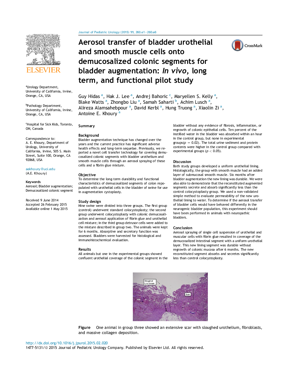 Aerosol transfer of bladder urothelial and smooth muscle cells onto demucosalized colonic segments for bladder augmentation: InÂ vivo, long term, and functional pilot study