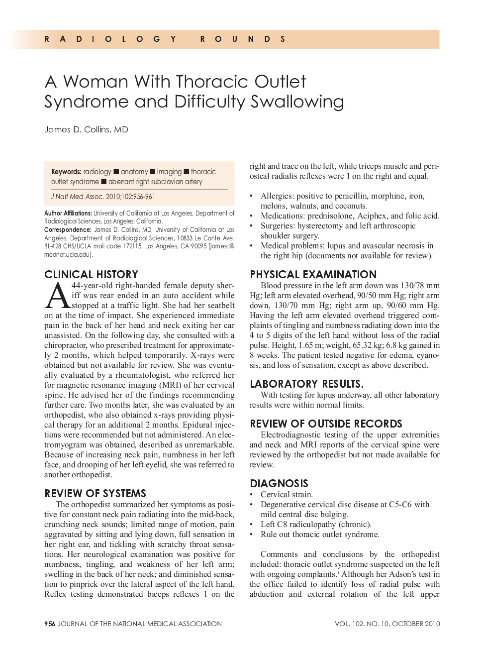 A Woman With Thoracic Outlet Syndrome and Difficulty Swallowing