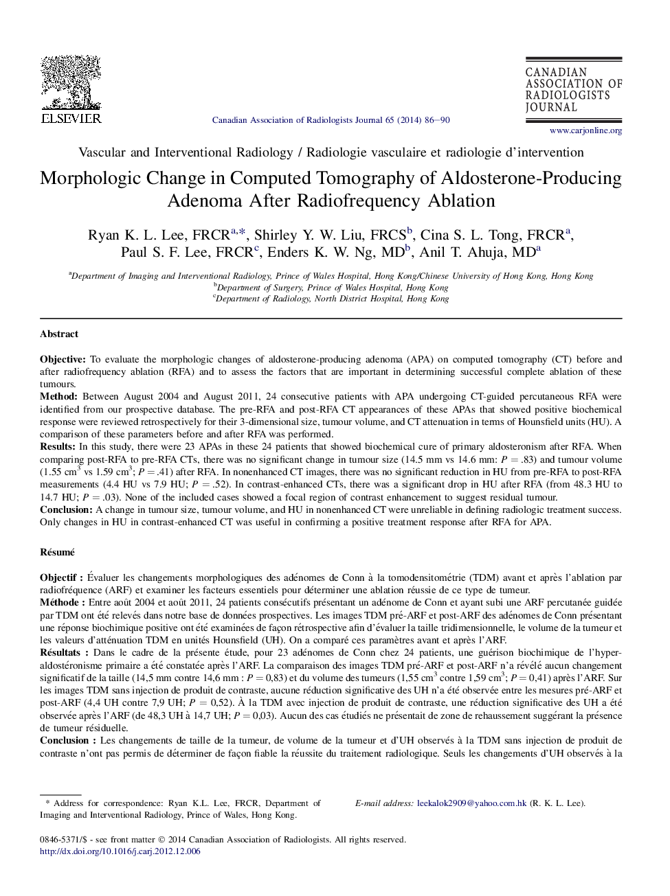 تغییرات مورفولوژیکی در توموگرافی کامپیوتری آلدسترون تولید آدرنوم پس از تخریب رادیوفرکوویسی 