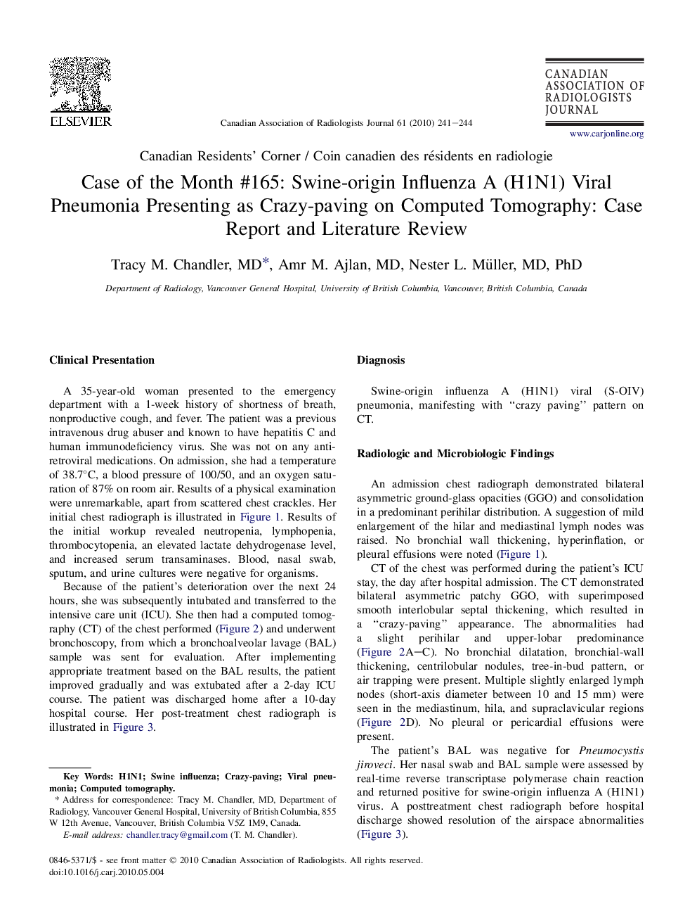 Case of the Month #165: Swine-origin Influenza A (H1N1) Viral Pneumonia Presenting as Crazy-paving on Computed Tomography: Case Report and Literature Review