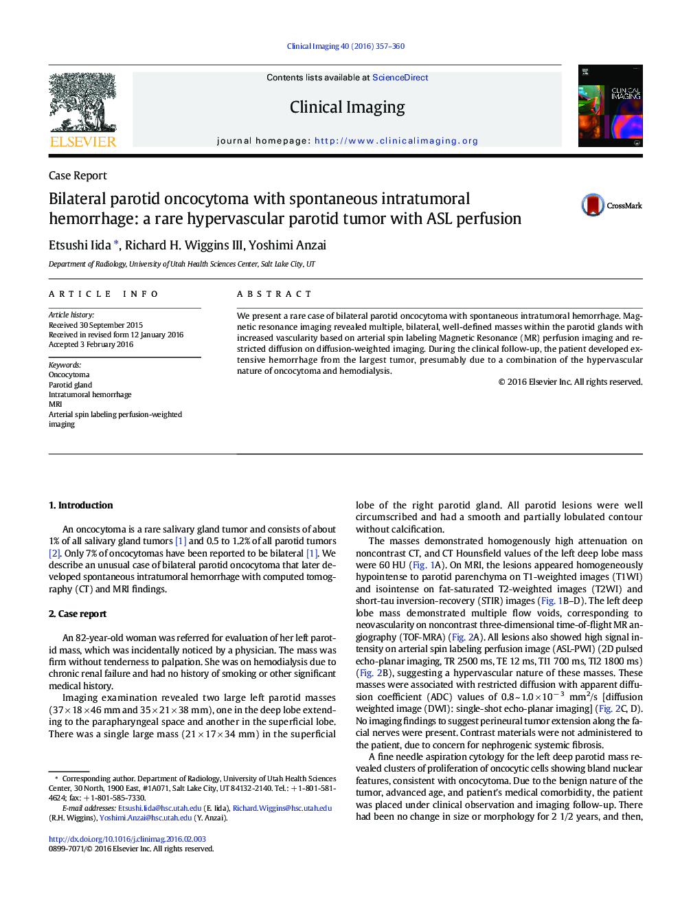 Bilateral parotid oncocytoma with spontaneous intratumoral hemorrhage: a rare hypervascular parotid tumor with ASL perfusion