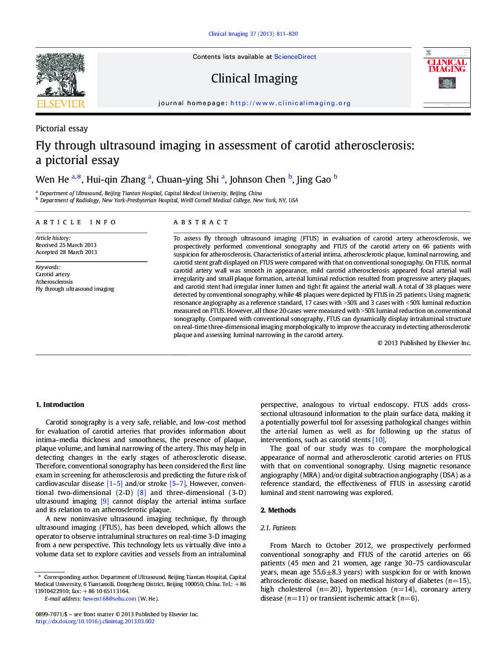 Fly through ultrasound imaging in assessment of carotid atherosclerosis: a pictorial essay