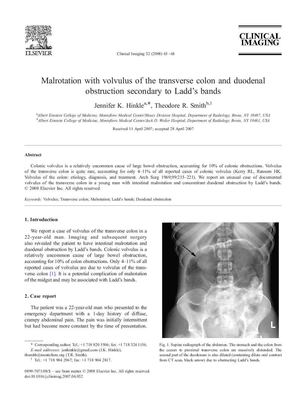 Malrotation with volvulus of the transverse colon and duodenal obstruction secondary to Ladd's bands