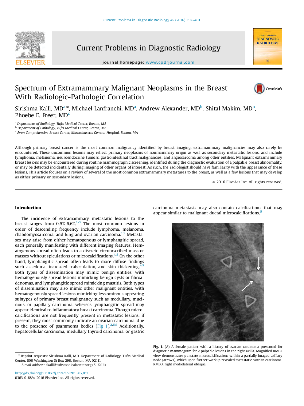 Spectrum of Extramammary Malignant Neoplasms in the Breast With Radiologic-Pathologic Correlation