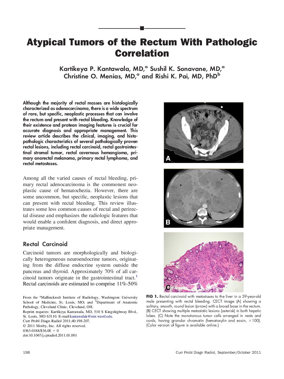 Atypical Tumors of the Rectum With Pathologic Correlation