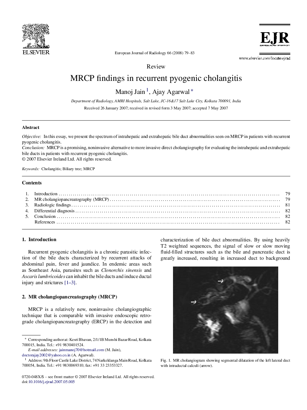 MRCP findings in recurrent pyogenic cholangitis