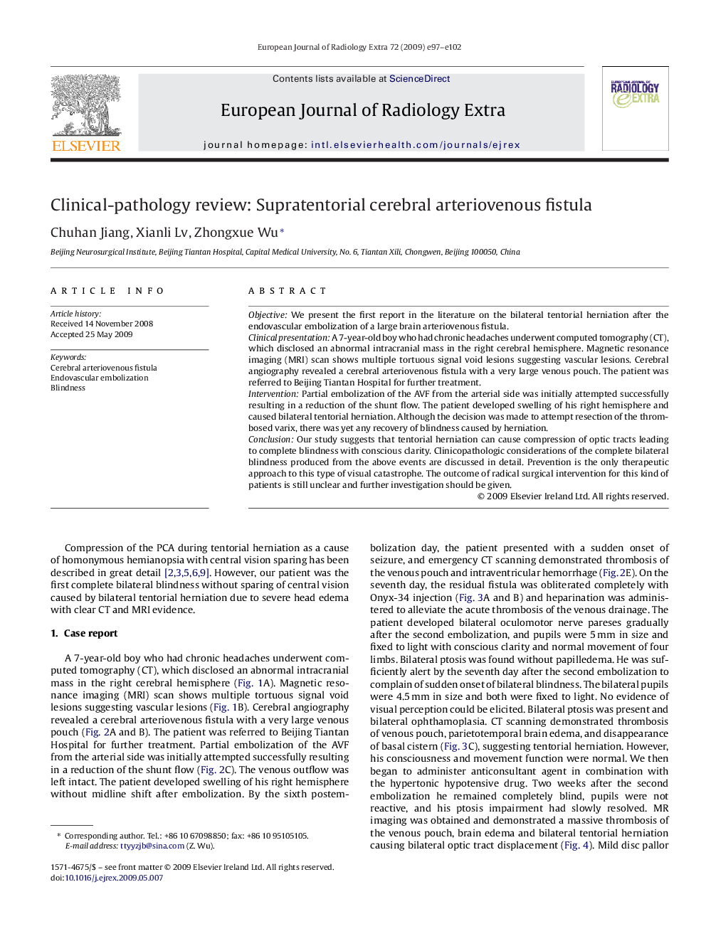 Clinical-pathology review: Supratentorial cerebral arteriovenous fistula