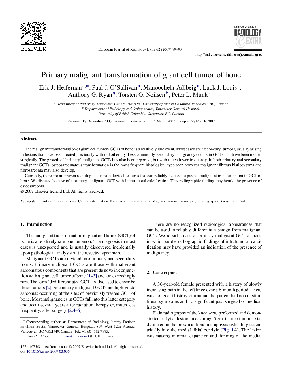 Primary malignant transformation of giant cell tumor of bone