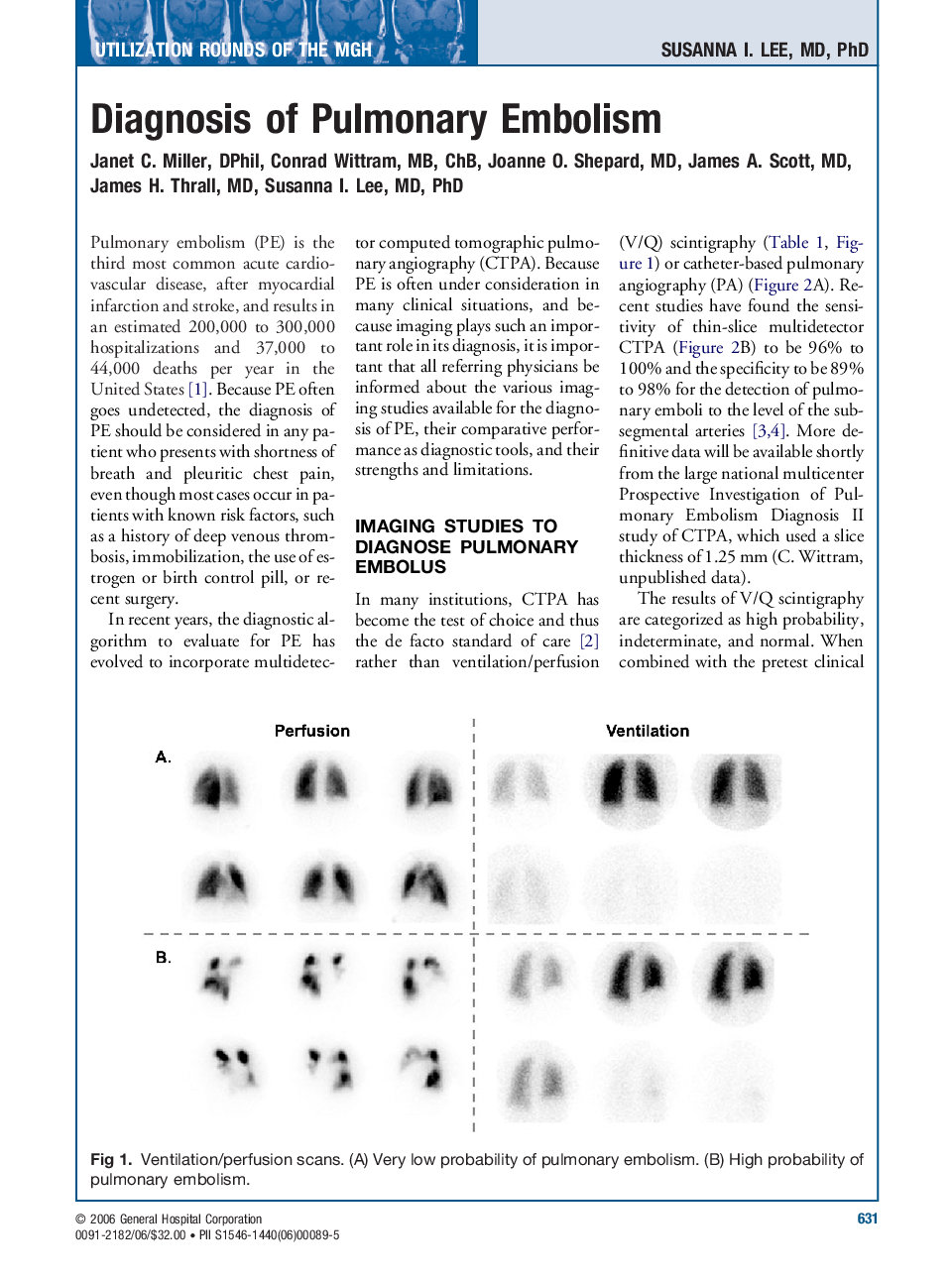 Diagnosis of Pulmonary Embolism