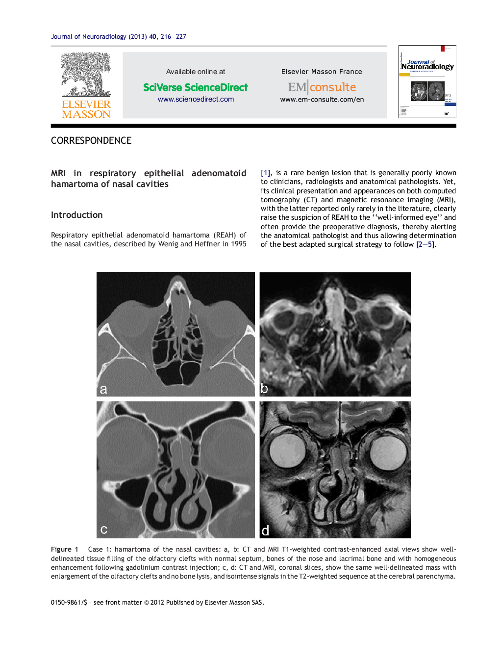 MRI in respiratory epithelial adenomatoid hamartoma of nasal cavities