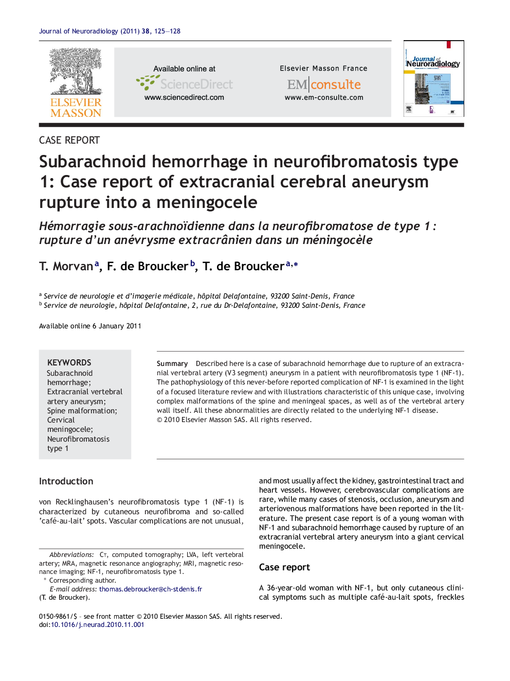 Subarachnoid hemorrhage in neurofibromatosis type 1: Case report of extracranial cerebral aneurysm rupture into a meningocele