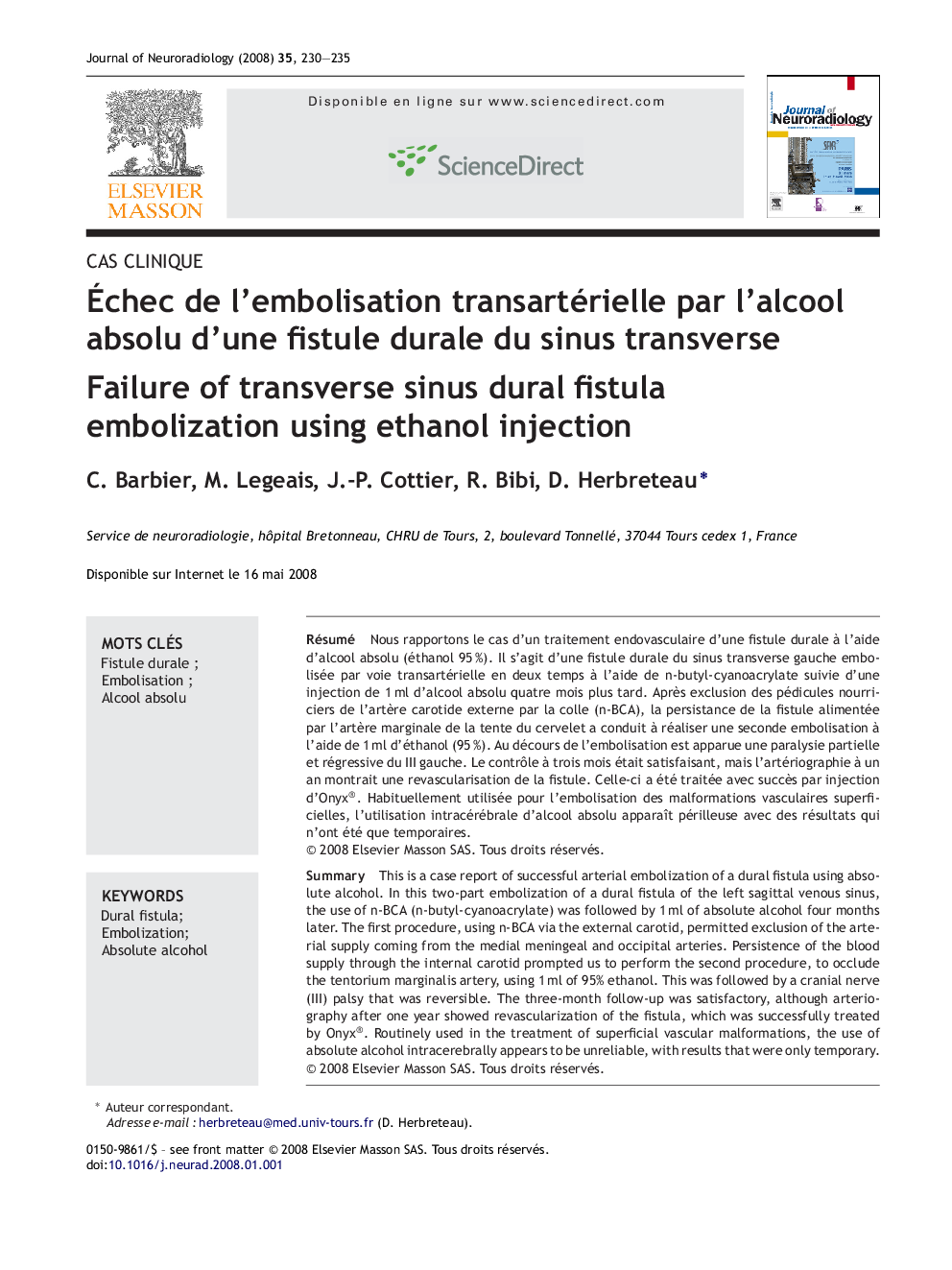 Ãchec de l'embolisation transartérielle par l'alcool absolu d'une fistule durale du sinus transverse