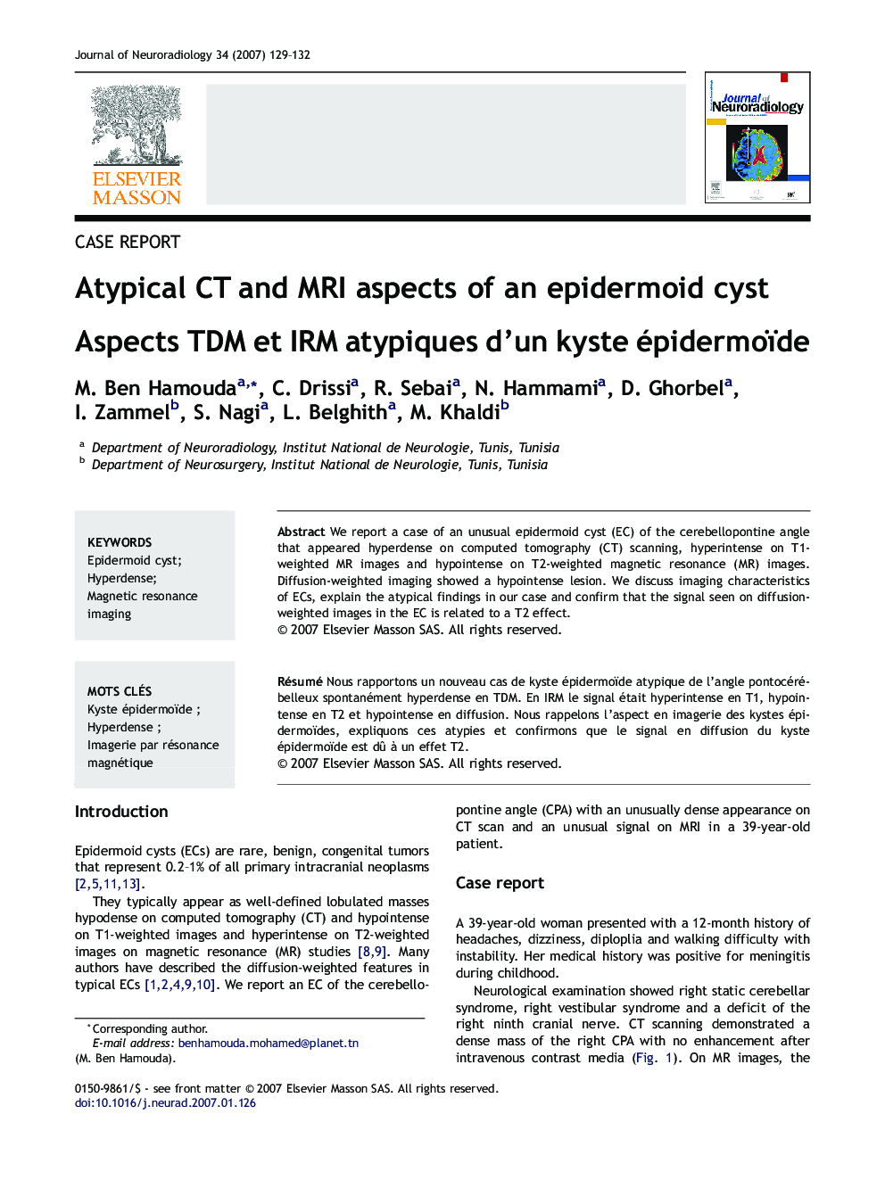 Atypical CT and MRI aspects of an epidermoid cyst