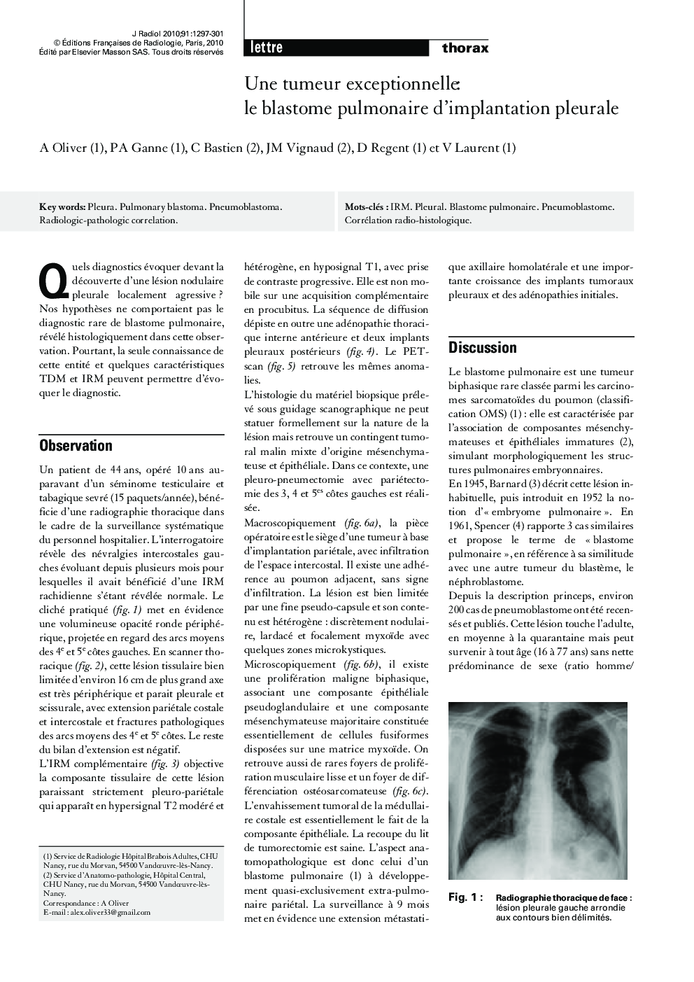 Une tumeur exceptionnelleÂ : le blastome pulmonaire d'implantation pleurale