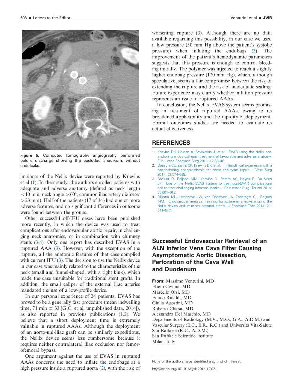 Successful Endovascular Retrieval of an ALN Inferior Vena Cava Filter Causing Asymptomatic Aortic Dissection, Perforation of the Cava Wall and Duodenum