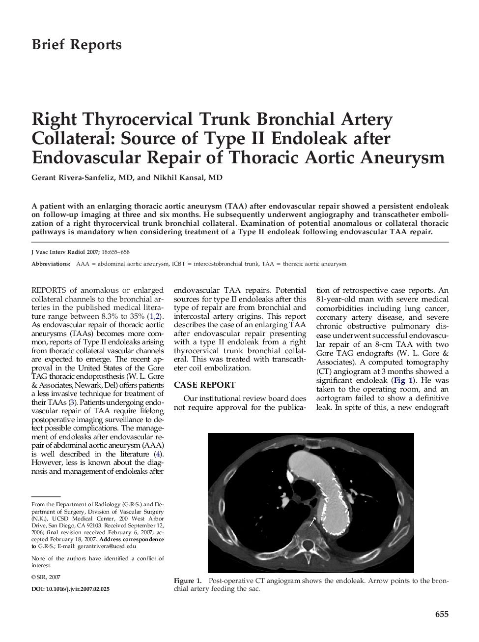 Right Thyrocervical Trunk Bronchial Artery Collateral: Source of Type II Endoleak after Endovascular Repair of Thoracic Aortic Aneurysm