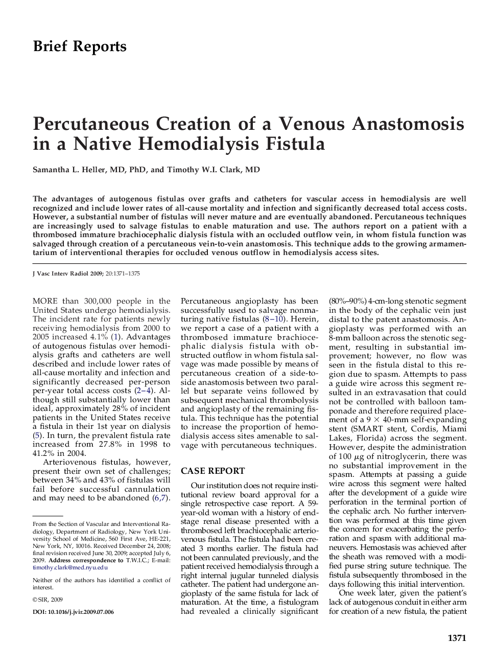 Percutaneous Creation of a Venous Anastomosis in a Native Hemodialysis Fistula